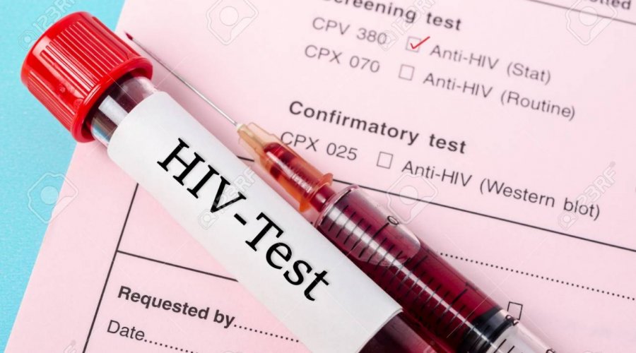 [Mais de 150 pessoas foram diagnosticadas com HIV em Feira de Santana no 1° semestre do ano]