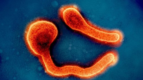 [Doença prima do ebola mata 12 em novo surto; entenda o vírus de Marburg]