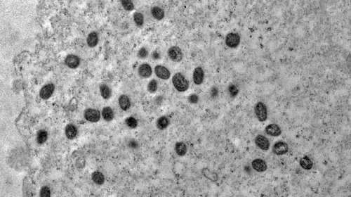 [Ministério da Saúde afirma que casos de mpox no Brasil não indicam situação de alerta]