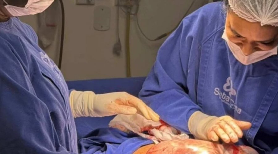 [Hospital do Recôncavo registra três nascimentos empelicados em um único dia]