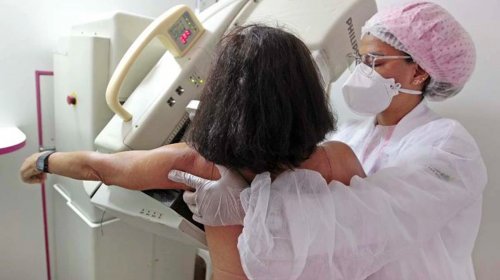 [Março Mulher oferece exames ao público feminino no Hospital Municipal]