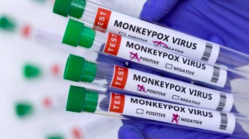 [Ministério da Saúde confirma mais dois casos de Varíola dos Macacos]