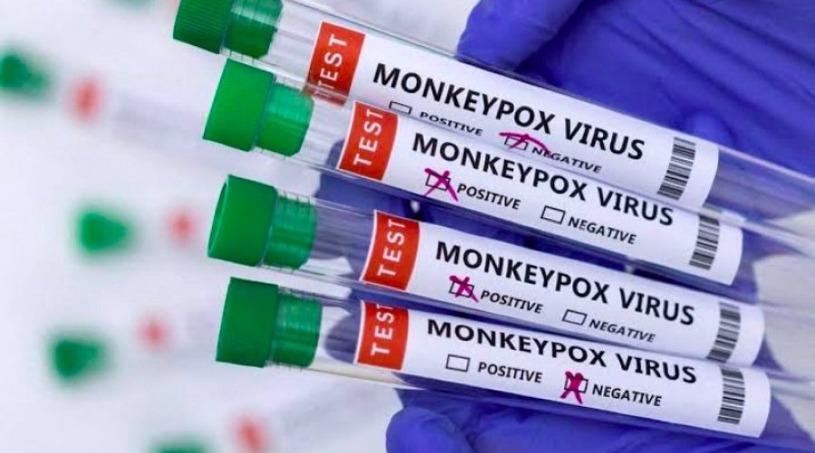[Ministério da Saúde confirma mais dois casos de Varíola dos Macacos]