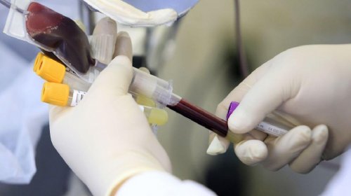 [Anvisa faz recomendações sobre doação de sangue por pessoas infectadas pela varíola dos macaco...]